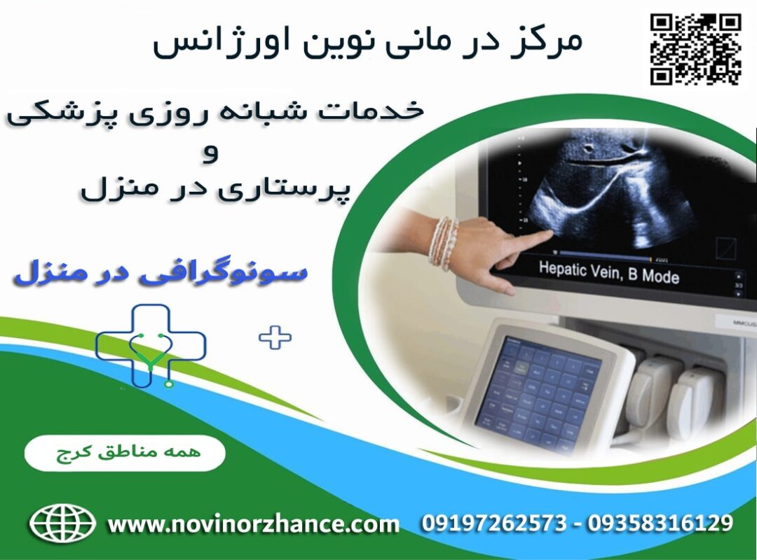 سونوگرافی در منزل