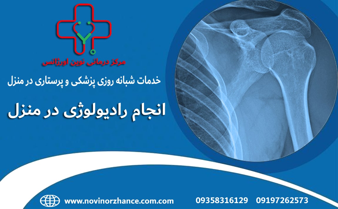 رادیولوژی در منزل نوین اورژانس