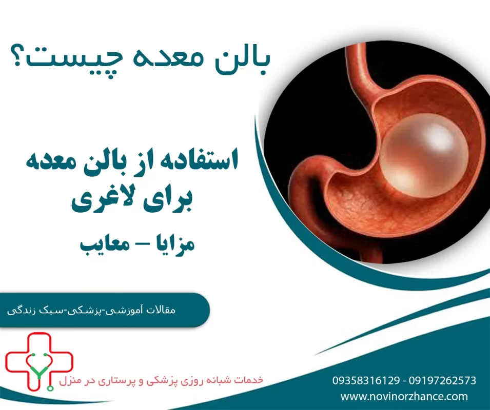 بالن معده چیست
